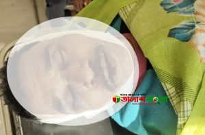 বুড়িচংয়ে নারিকেল গাছ থেকে পড়ে এক ইউপি সদস্যের মৃত্যু