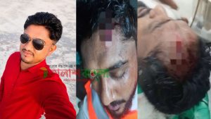 বুড়িচংয়ে ৯৯৯ নম্বরে ফোন দিয়ে নিয়ে পুলিশের ওপর হামলা;এক কনস্টেবলকে কুপিয়ে জখম